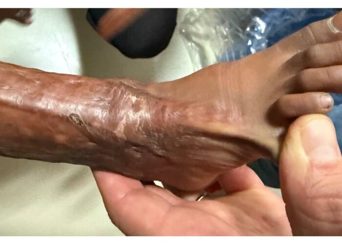 Photo 1 pied